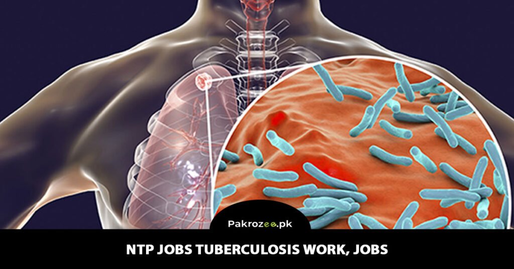 NTP Jobs Tuberculosis Work, Jobs